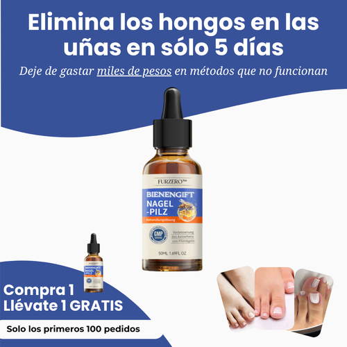 NailGift™ | Elimina el 97% de las infecciones de uñas en solo 10 días